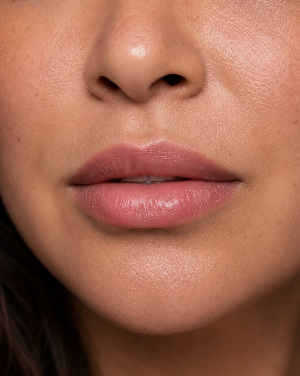 Restylane®